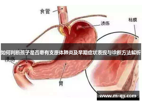 如何判断孩子是否患有支原体肺炎及早期症状表现与诊断方法解析